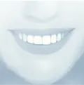 Sorriso